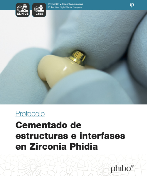 Cementado de estructuras e interfases en Zirconia Phidia